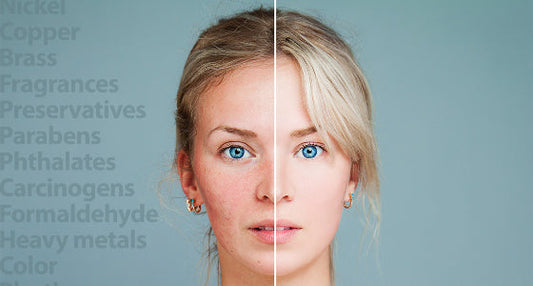 Skin Irritants That Are Commonly Found In Beauty Products